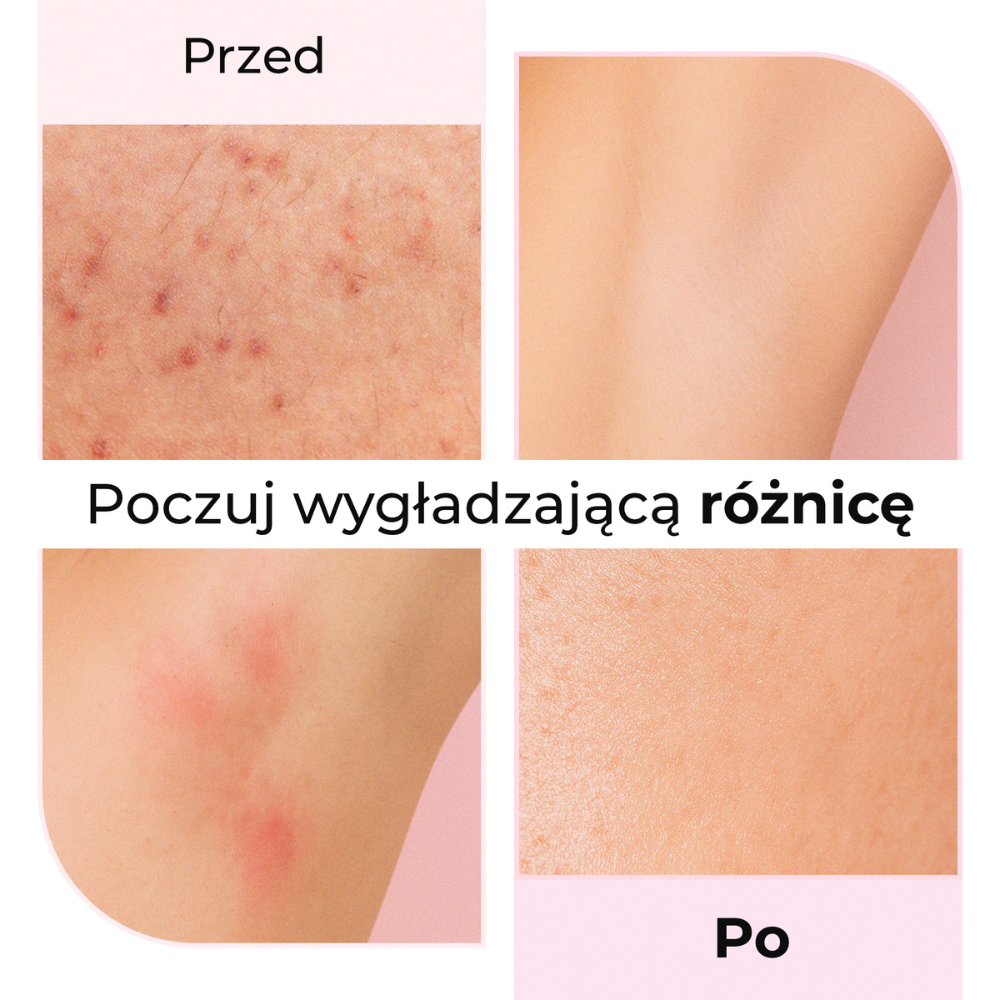 Efekt przed i po użyciu olejku po goleniu Silky Balloon Lumisilk — wygładzona skóra, mniej podrażnień i zaczerwienień.