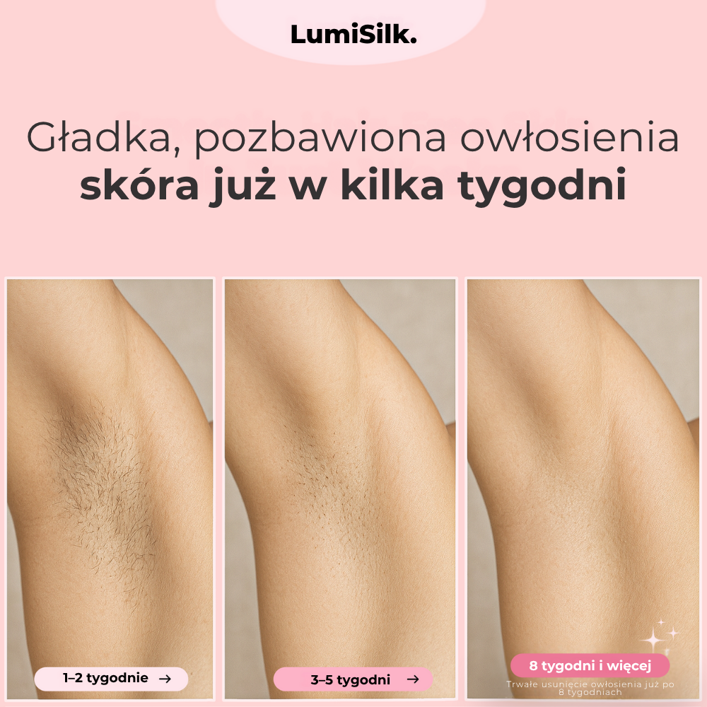 Efekty depilacji IPL Lumina pod pachami po 1 do 8 tygodniach