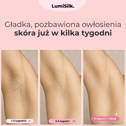 Efekty depilacji IPL Lumina pod pachami po 1 do 8 tygodniach
